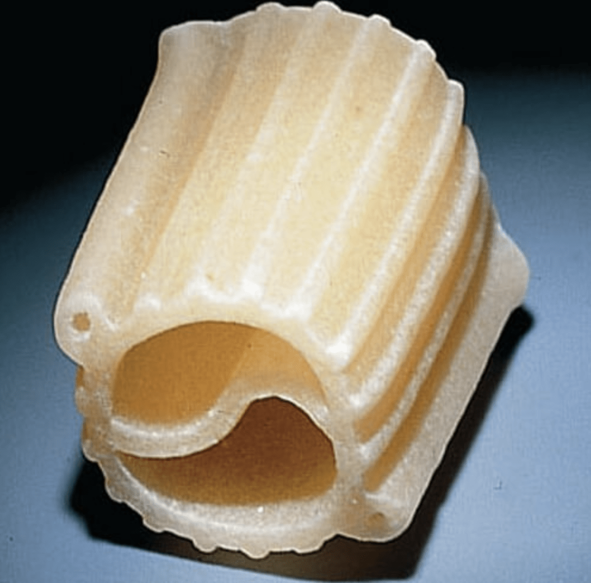 NewAge Noodles The 1980s Culinary Experiment from France